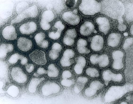 Il virus dell’influenza aviaria (fonte: CDC)