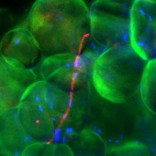 Cellule del tessuto adiposo (fonte: UMHealthSystem, via Flickr)